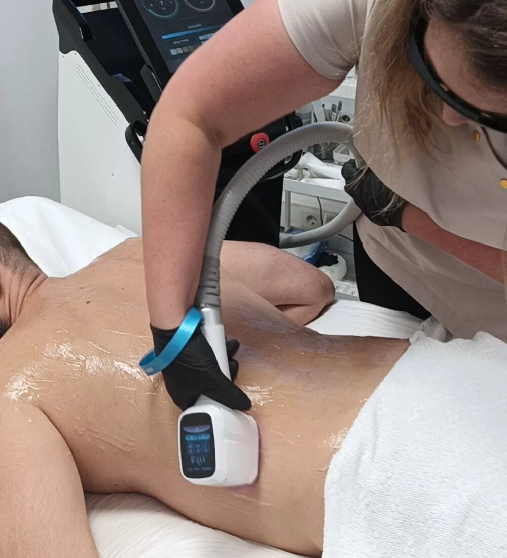 Laserontharing Vrouwen